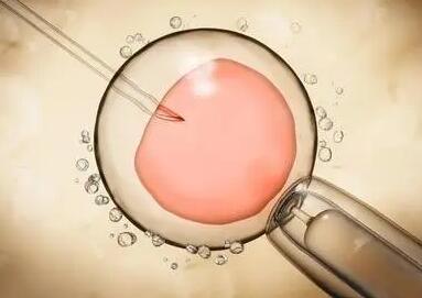 输卵管积水也能做试管婴儿试管婴儿技术是治疗不孕不育的新方案